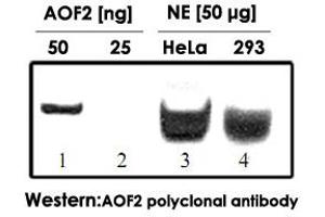 Western blot was performed using AOF2 polyclonal antibody  diluted 1 : 1,000 in TBS-Tween containing 5% skimmed milk.