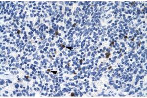 Immunohistochemical staining (Formalin-fixed paraffin-embedded sections) of human spleen with HTR3B polyclonal antibody . (Serotonin Receptor 3B Antikörper  (AA 8-57))