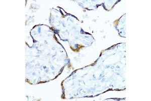 Immunohistochemistry of paraffin-embedded human placenta using Aromatase (CYP19) antibody  at dilution of 1:100 (40x lens).