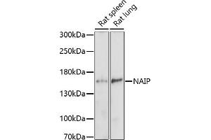 Western blot analysis of extracts of various cell lines, using NAIP antibody (ABIN7268932) at 1:1000 dilution. (NAIP Antikörper  (AA 750-850))