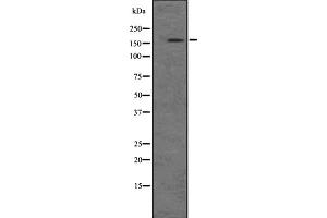 Western blot analysis of PIK3C2B expression in A-431 cell lysate at 25ug/lane. (PIK3C2B Antikörper  (Internal Region))
