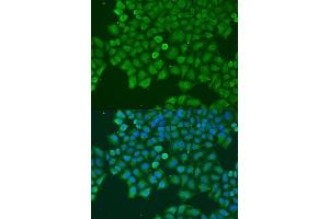 Immunofluorescence analysis of U2OS cells using CAST antibody (ABIN6290228) at dilution of 1:100. (Calpastatin Antikörper)