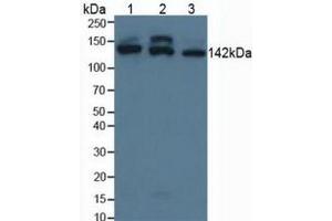 Figure. (SMC3 Antikörper  (AA 994-1181))
