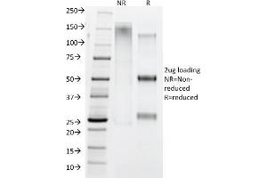 SDS-PAGE Analysis IgG4 Mouse Monoclonal Antibody (IGHG4/1345). (IGHG4 Antikörper)