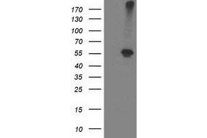 Western Blotting (WB) image for anti-Alcohol Dehydrogenase 1B (Class I), beta Polypeptide (ADH1B) antibody (ABIN1496476)