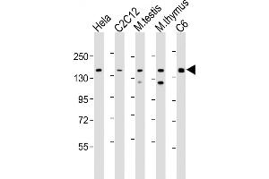 All lanes : Anti-Smarcc1 Antibody (C-term) at 1:2000 dilution Lane 1: Hela whole cell lysate Lane 2: C2C12 whole cell lysate Lane 3: mouse testis lysate Lane 4: mouse thymus lysate Lane 5: C6 whole cell lysate Lysates/proteins at 20 μg per lane. (SMARCC1 Antikörper  (C-Term))