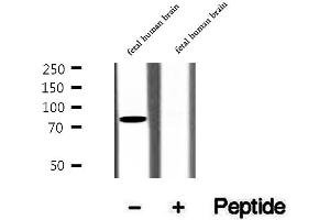 Western blot analysis of extracts of fetal human brain tissue, using CIN85 antibody. (SH3KBP1 Antikörper  (N-Term))