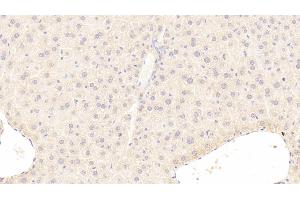 Immunohistochemistry (IHC) image for anti-Carnitine O-Acetyltransferase (CRAT) (AA 1-430) antibody (ABIN7434875)