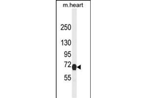 Western blot analysis of NGFR Antibody (ABIN2802041 and ABIN6577055) in mouse heart tissue lysates (35 μg/lane). (NGFR Antikörper)