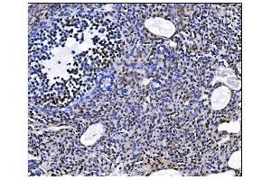 IHC analysis of EHMT2/G9A using anti-EHMT2/G9A antibody (ABIN7602084). (EHMT2 Antikörper  (AA 580-1195))