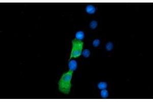 Anti-SSSCA1 mouse monoclonal antibody (ABIN2453694) immunofluorescent staining of COS7 cells transiently transfected by pCMV6-ENTRY SSSCA1 (RC201946). (SSSCA1 Antikörper)