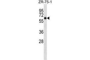 ARSD Antibody (C-term) western blot analysis in ZR-75-1 cell line lysates (35µg/lane). (Arylsulfatase D Antikörper  (C-Term))