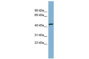 WB Suggested Anti-EFCAB4B Antibody Titration:  0. (EFCAB4B Antikörper  (Middle Region))