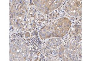 IHC analysis of TTC11/FIS1 using anti-TTC11/FIS1 antibody (ABIN7600321). (Fission 1 Antikörper  (AA 18-152))