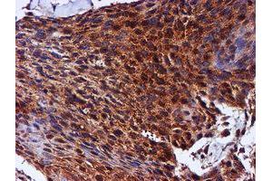 Image no. 11 for anti-Chromosome 1 Open Reading Frame 50 (C1ORF50) antibody (ABIN1497033)