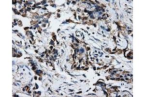 Immunohistochemical staining of paraffin-embedded liver tissue using anti-ATP5Bmouse monoclonal antibody. (ATP5B Antikörper)
