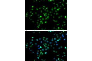 Immunofluorescence analysis of MCF-7 cells using RBBP6 antibody (ABIN5974190).