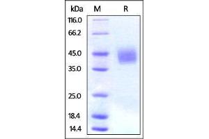 Human B7-H3, His Tag on SDS-PAGE under reducing (R) condition. (CD276 Protein (CD276) (AA 29-245) (His tag))