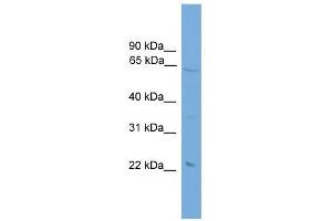 Western Blot showing EHD1 antibody used at a concentration of 1-2 ug/ml to detect its target protein. (EHD1 Antikörper  (Middle Region))
