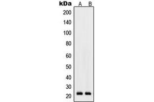 Western blot analysis of RhoD expression in K562 (A), Raw264. (RHOD Antikörper  (Center))