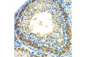 Immunohistochemistry (Paraffin-embedded Sections) (IHC (p)) image for anti-Mitochondrial Ribosomal Protein L28 (MRPL28) (AA 1-256) antibody (ABIN6144010)