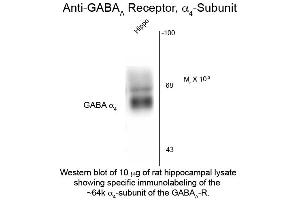 Western Blot of Anti-GABA(A) Receptor alpha 4 (Rabbit) Antibody - 612-401-D47 Western Blot of Anti-GABA(A) Receptor alpha 4 (Rabbit) Antibody. (GABRA4 Antikörper  (Cytoplasmic Loop))