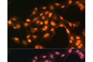 Immunofluorescence analysis of C6 cells using Snail Polyclonal Antibody at dilution of 1:100. (SNAIL Antikörper)