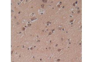 IHC-P analysis of Kidney tissue, with DAB staining. (IP6K1 Antikörper  (AA 1-300))