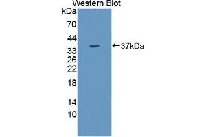 Western blot analysis of the recombinant protein. (CA8 Antikörper  (AA 1-290))