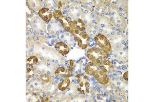 Immunohistochemistry of paraffin-embedded rat kidney using MAP1LC3B antibody at dilution of 1:100 (x400 lens).