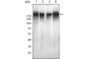 Western blot analysis using EGFR mutant antibody against SPC-A-1 (1), A549 (2), HepG2 (3) and MCF-7 (4) cell lysate. (EGFR Mutant (AA 693-893), (Mutant) Antikörper)