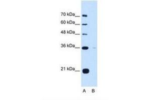 Image no. 1 for anti-Torsin Family 1, Member B (Torsin B) (TOR1B) (AA 251-300) antibody (ABIN321197)
