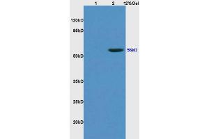 L1 rat kidney lysates L2 human colon carcinoma lysates probed with Anti KLF4 Polyclonal Antibody, Unconjugated (ABIN737121) at 1:200 overnight at 4 °C. (KLF2/4 Antikörper  (AA 415-513))