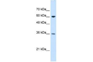 WB Suggested Anti-STIP1 Antibody Titration:  1. (STIP1 Antikörper  (N-Term))