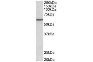 Antibody (1µg/ml) staining of Human Breast cancer lysate (35µg protein in RIPA buffer). (ZNF703 Antikörper  (Internal Region))