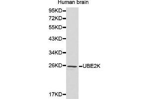 Western Blotting (WB) image for anti-Ubiquitin-Conjugating Enzyme E2K (UBE2K) (AA 1-100) antibody (ABIN6215017) (UBE2K Antikörper  (AA 1-100))