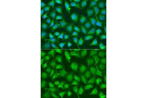 Immunofluorescence analysis of A549 cells using XRCC2 antibody. (XRCC2 Antikörper)