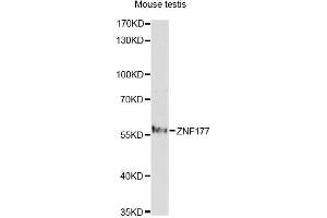 Western blot analysis of extracts of mouse testis, using ZNF177 antibody. (ZNF177 Antikörper)
