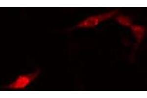 ABIN6275774 staining HuvEc cells by IF/ICC. (IGF2BP2 Antikörper  (C-Term))