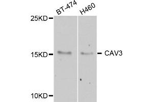 Western blot analysis of extracts of various cell lines, using CAV3 antibody (ABIN5974782) at 1/1000 dilution. (Caveolin 3 Antikörper)