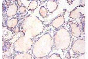 Immunohistochemistry of paraffin-embedded human thyroid tissue using ABIN7150042 at dilution of 1:100