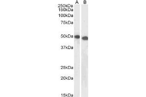 ABIN5539626 (1µg/ml) staining of Jurkat (A) and K562 (B) lysates (35µg protein in RIPA buffer).