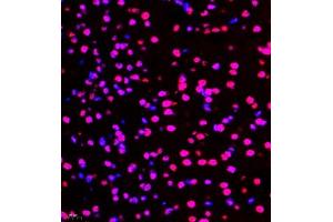 Immunofluorescence of paraffin embedded mouse brain using smad62024 (ABIN7075629) at dilution of 1:1000 (400x lens)
