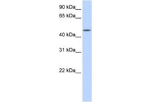 WB Suggested Anti-C20orf160 Antibody Titration: 0. (C20orf160 Antikörper  (N-Term))
