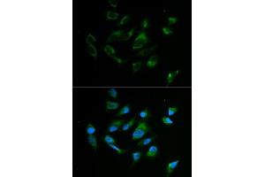 Immunofluorescence analysis of MCF7 cell using TYR antibody. (TYR Antikörper)