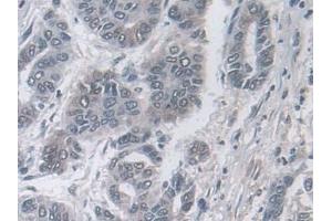 Immunohistochemistry (IHC) image for anti-Ubiquitin (Ub) (AA 1-229) antibody (ABIN7443803)