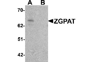 Western blot analysis of ZGPAT in SK-N-SH cell lysate with ZGPAT antibody at 1 µg/mL in (A) the absence and (B) the presence of blocking peptide. (ZGPAT Antikörper  (C-Term))