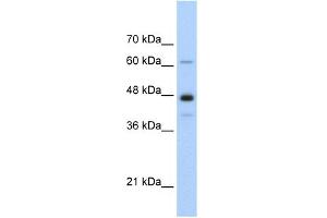 WB Suggested Anti-NXF1 Antibody Titration:  0. (NXF1 Antikörper  (N-Term))