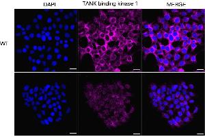Immunocytochemical staining of HeLa cells using TANK binding kinase 1 antibody (ABIN7800506), 1:1,000), Top panel: wild-type (WT), Bottom panal: TANK binding kinase 1 shRNA knockdown (KD). (Rekombinanter TBK1 Antikörper)
