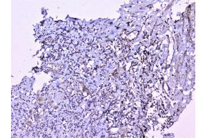 IHC analysis of cortactin using anti-cortactin antibody (ABIN6719306).
